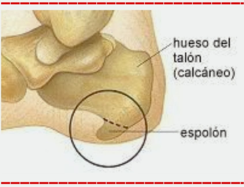 que es espolon en los pies